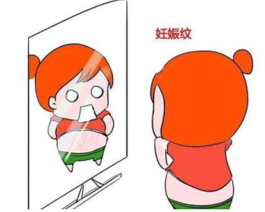 产后妊娠纹