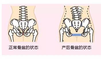产前产后骨盆对比图