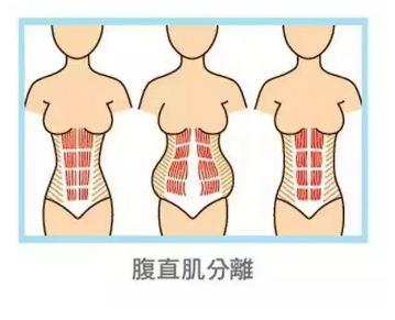 怀孕腹部对比图