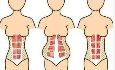 腹直肌